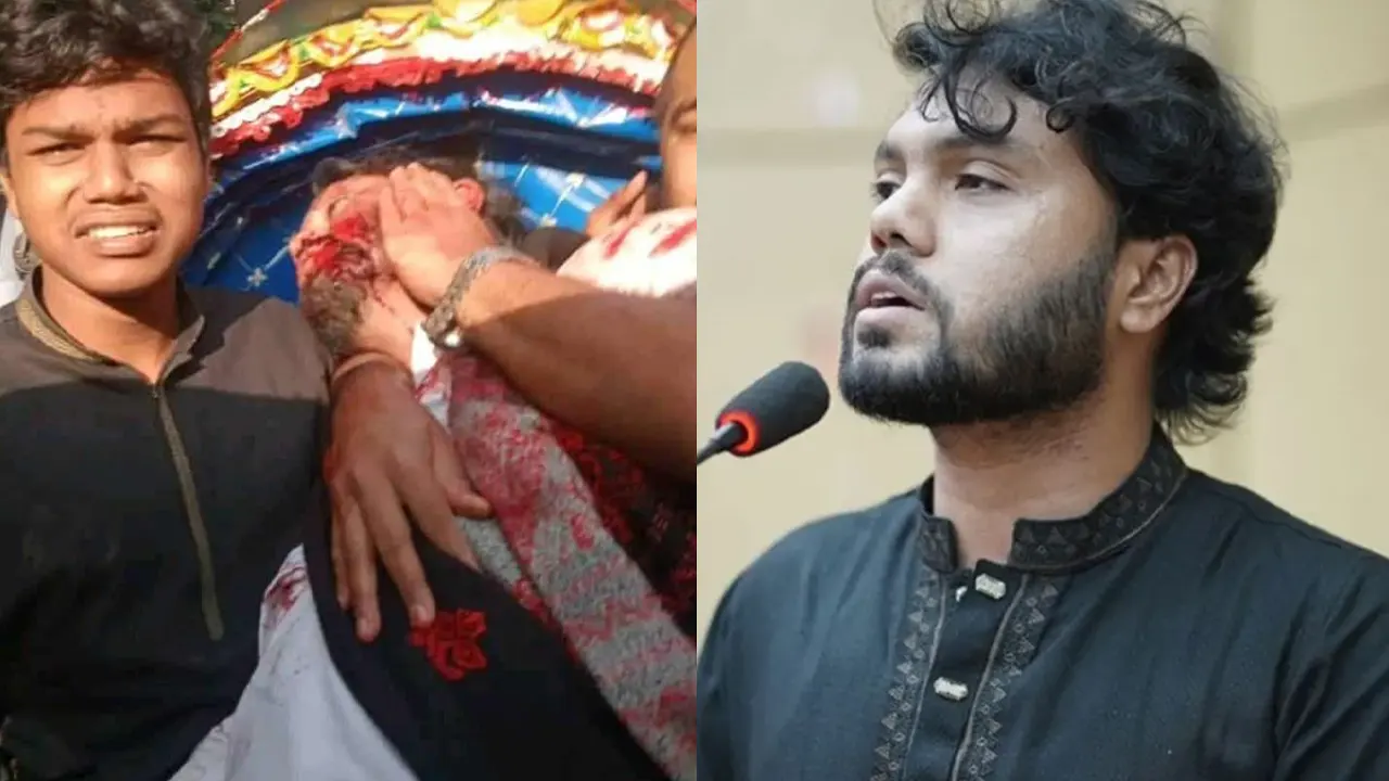 ওসমান হাদী গু' লি' বি' দ্ধ, নেওয়া হয়েছে ঢামেকে