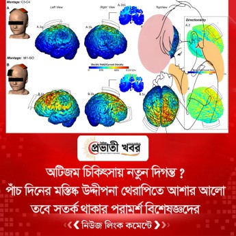 অটিজম চিকিৎসায় নতুন দিগন্ত ?