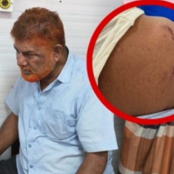আমঝুপিতে প্যানেল চেয়ারম্যানকে মারধরের অভিযোগ