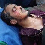 জবিতে প্ল্যাকার্ড প্রদর্শন ঘিরে হামলার অভিযোগ
